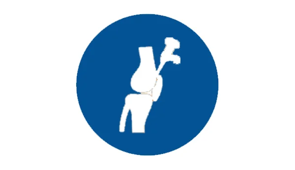 ACL Arthroscopy